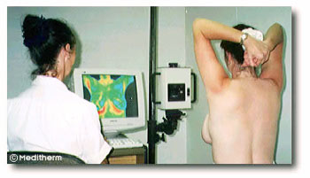 breast scan using digital infrared thermal imaging (DITI)