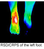 Digital Infrared Thermal Imaging (DITI)