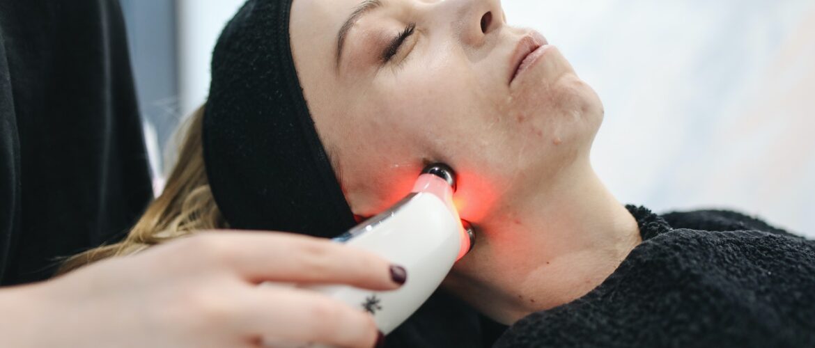 Laser treatment for facial hair remova