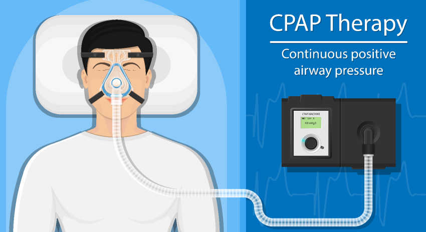 If you need to use a CPAP machine, consider the advantages of using purified water