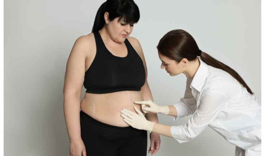 If you are considering weight loss surgery, ensure you understand the risks and commitments