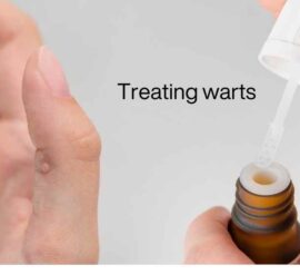 There are lots of options for treating warts from home remedies to medical treatment