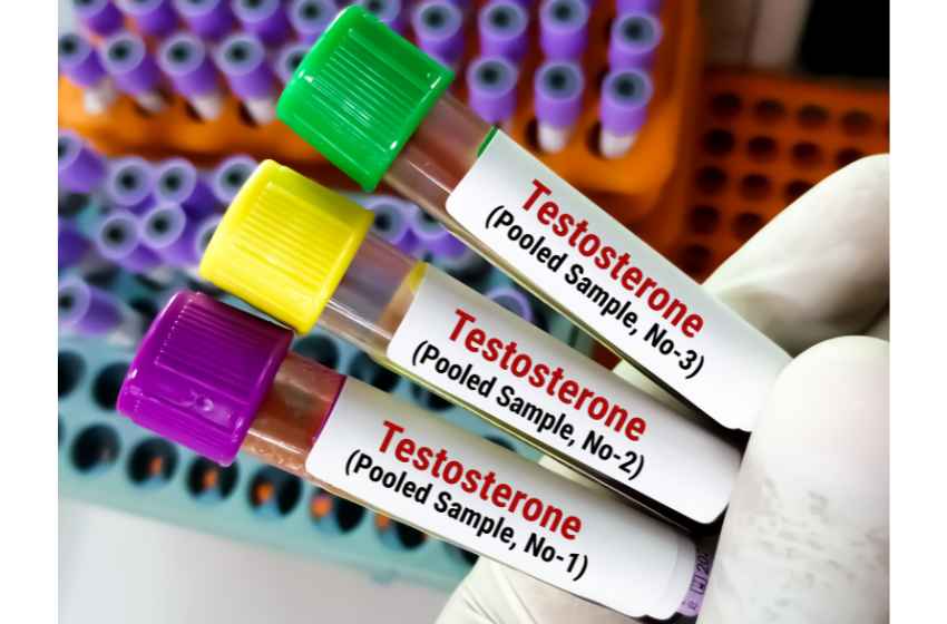 You may need to have a low testosterone test if you are showing sypmtons of Low T